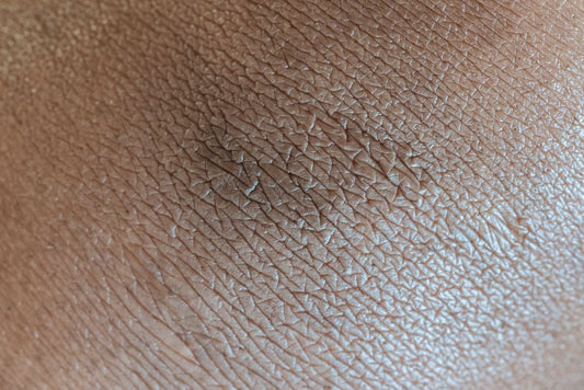 How to Know If Your Skin Barrier Is Damaged: 7 Signs to Look For